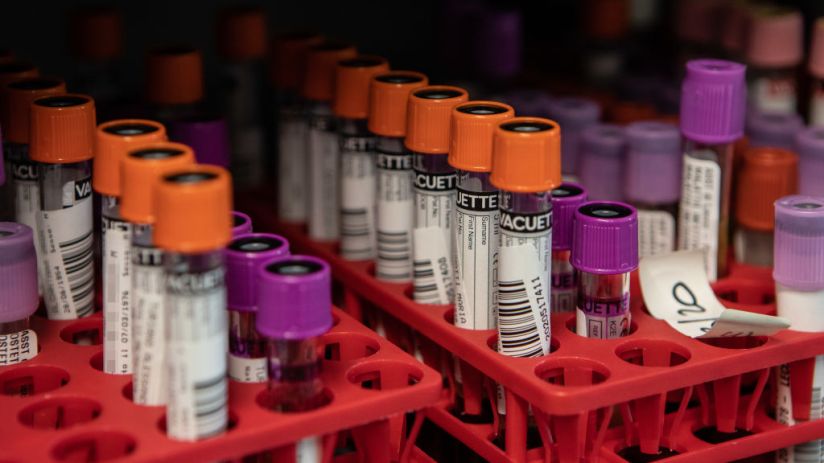 Swabs Are Tested For Coronavirus At Milan Laboratory